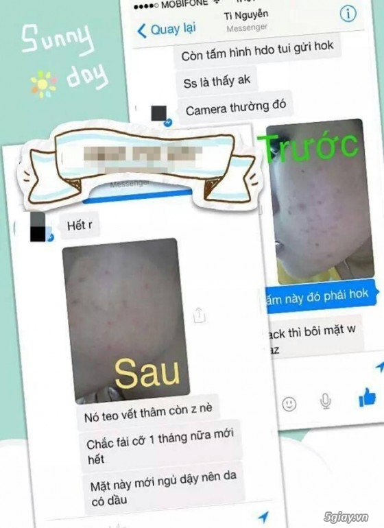 Mỹ Phẩm Trắng Da,Trị Mụn,Thâm, Nám..Hàng Cao Cấp,Chính Hãng,CAM KẾT BẢO HÀNH SẢN PHẨM - 29