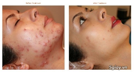 Mỹ Phẩm Cao Cấp Linh Hương - 1