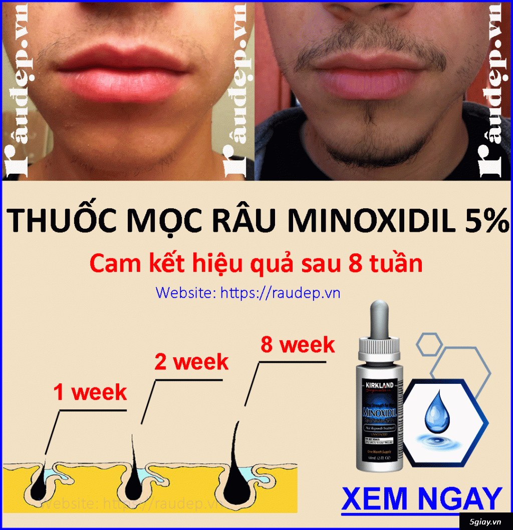 Thuốc Mọc Râu Quai Nón Minoxidil 5% của Mỹ >>|Chắc Chắn Mọc Râu| - 3