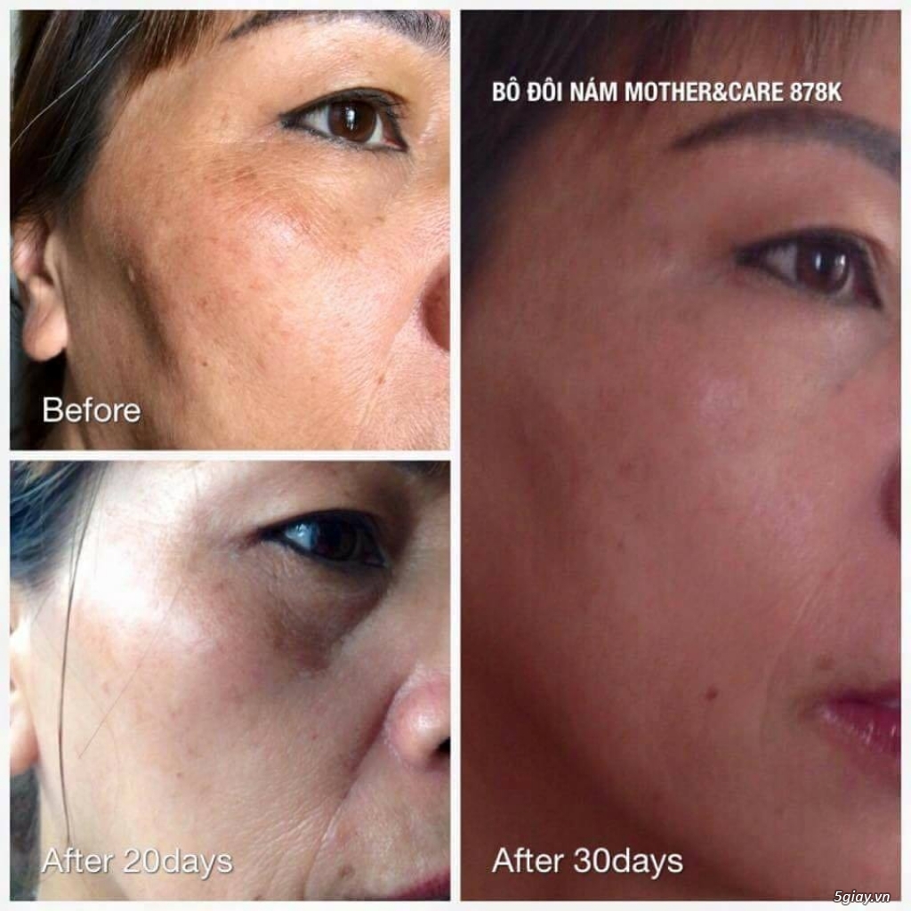 Tuyển CTV, khách sỉ, đại lý phân phối mỹ phẩm thiên nhiên - 1