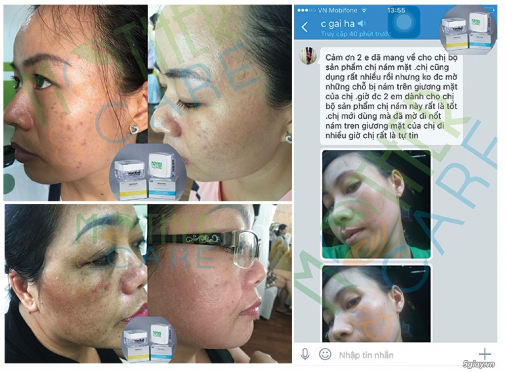 Tuyển CTV, khách sỉ, đại lý phân phối mỹ phẩm thiên nhiên