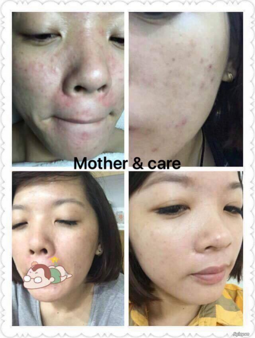 Tuyển CTV, khách sỉ, đại lý phân phối mỹ phẩm thiên nhiên - 2