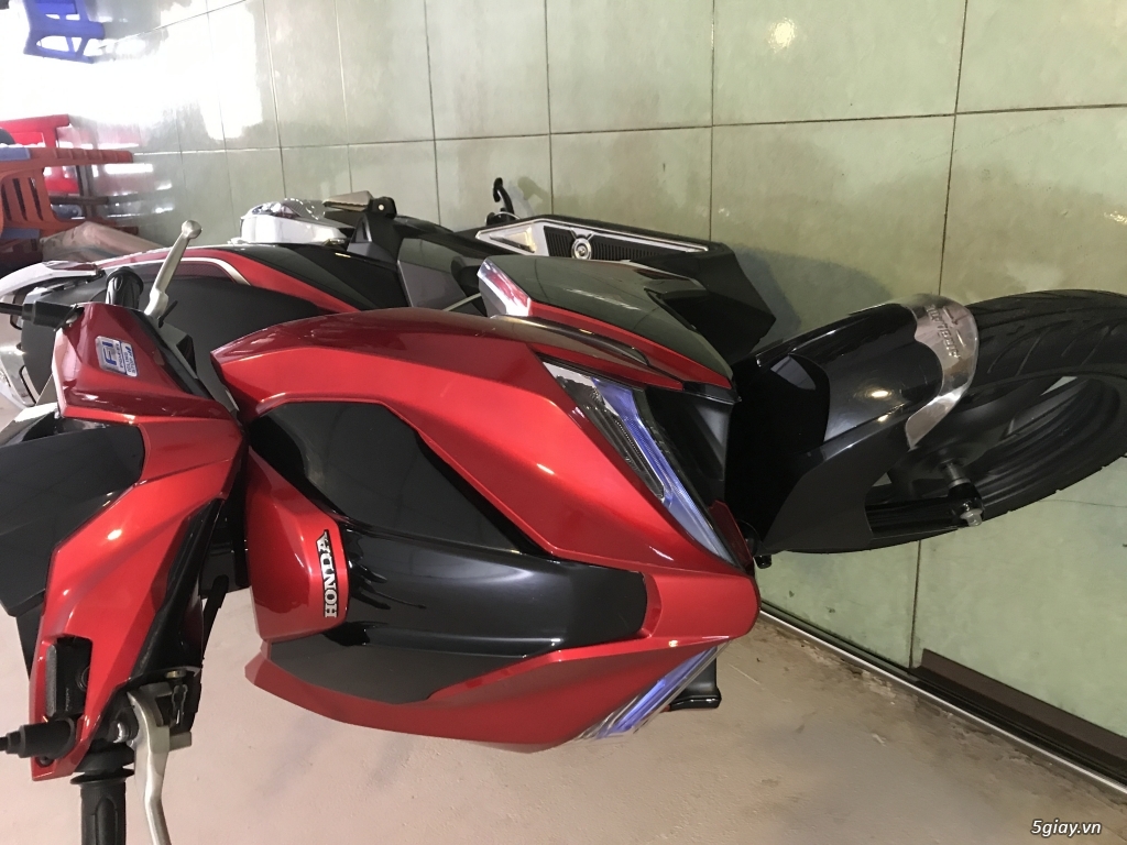 AB Mắt Híp Đời 2016 Ngay Chủ Bs TP - 5