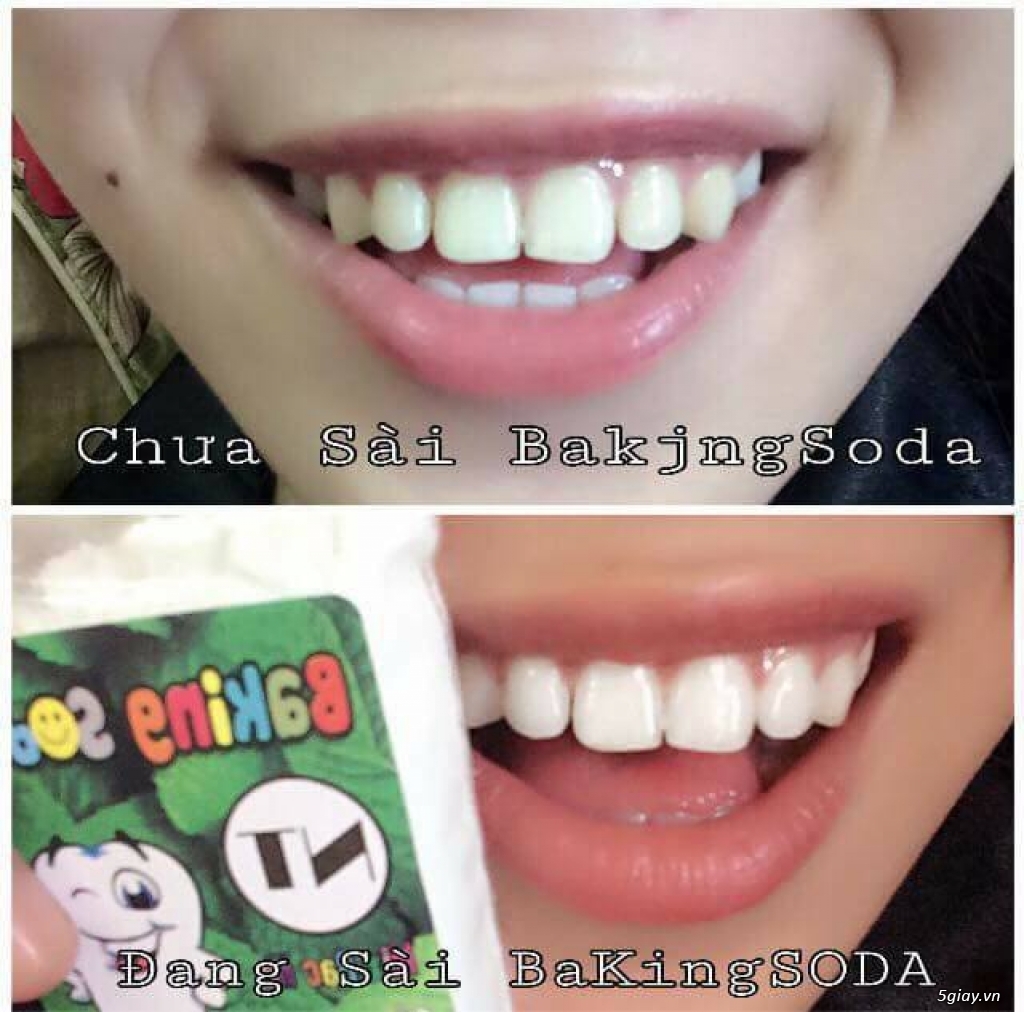 Cần bán: Baking soda Mix bạc hà - 13