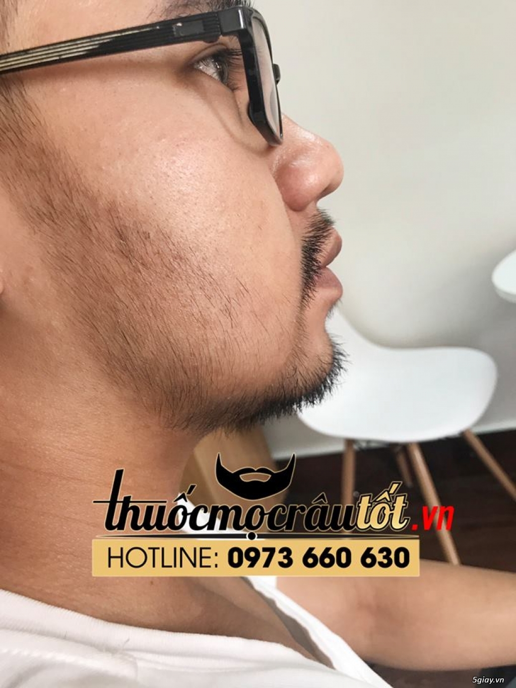Thuốc mọc râu tốt Minoxidil 5% - 4