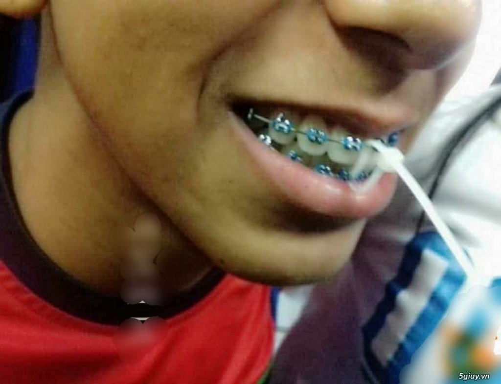khi thằng bạn nói nhiều thì phải làm sao