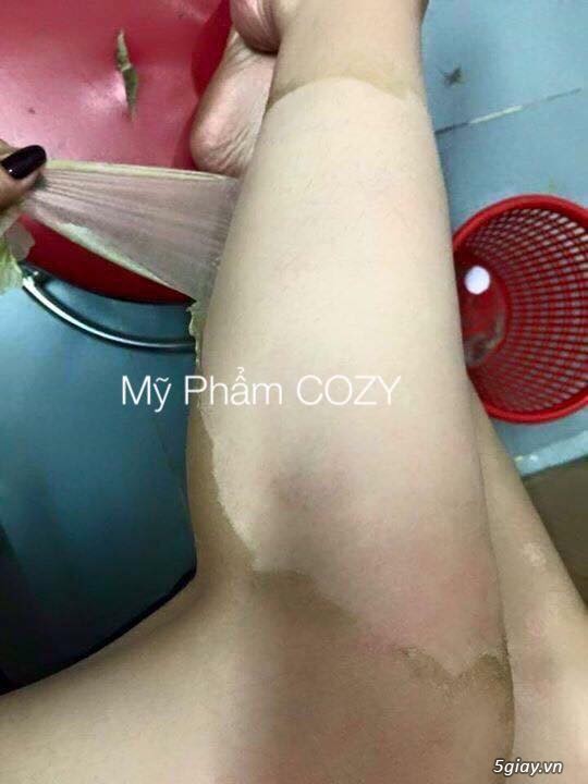 Thay da sinh học , Nước Lột tái tạo da COZY 3D cao cấp , lột trắng da - 7