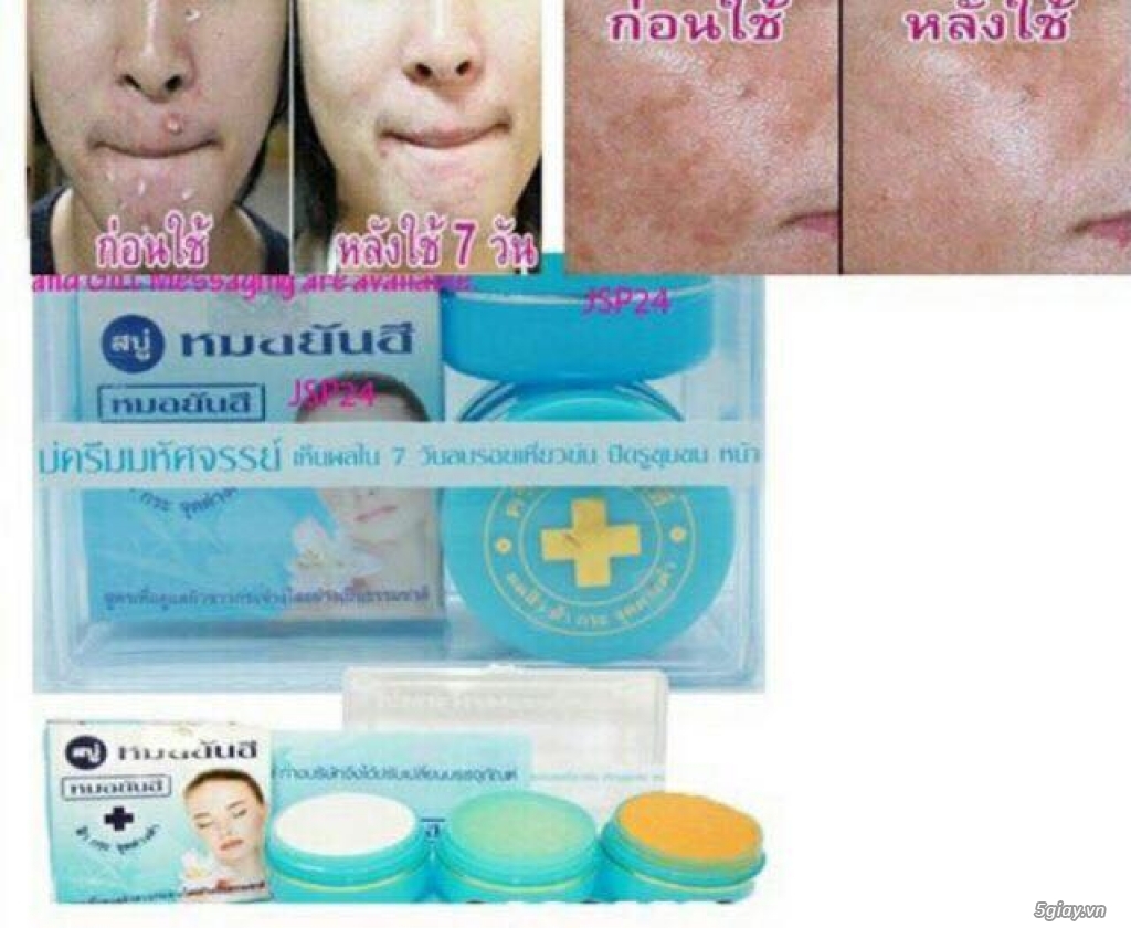 Bộ kem đặc trị mụn tái tạo da và làm trắng da của D.r Yanhee Thái Lan - 3