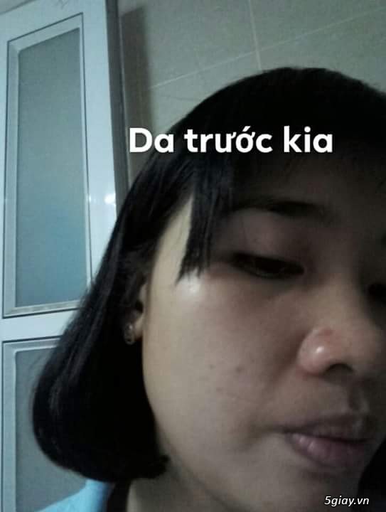 Thảo dược tái tạo da đông y MỘC NHÂN - 2