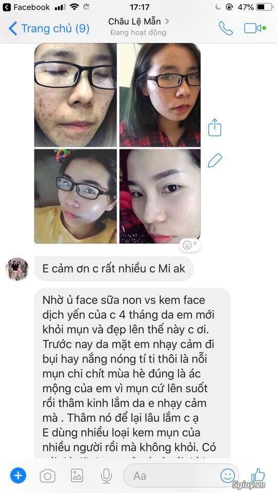 Combo ủ face sữa bò vitamin và kem face dịch yến chuyên sâu cho da mặt - 2
