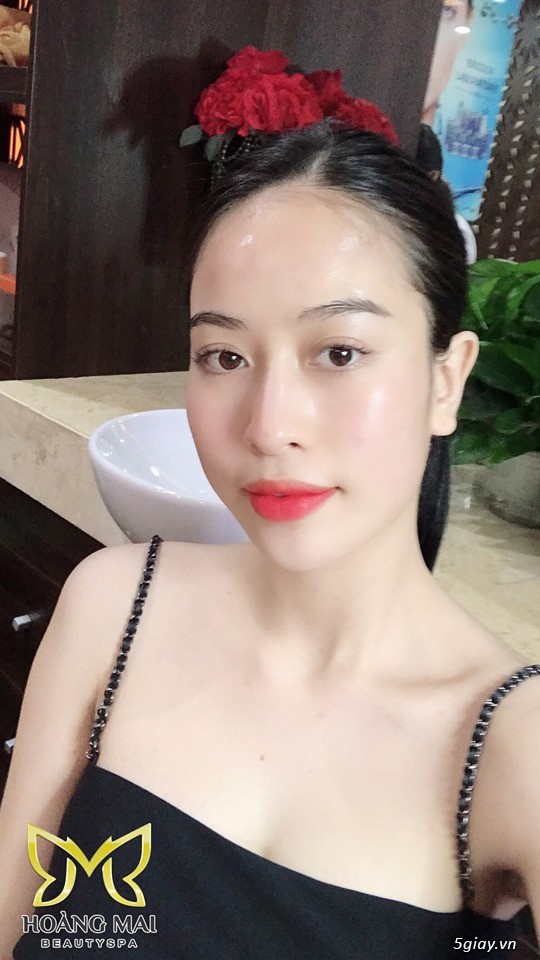 Dịch vụ thẩm mỹ uy tín- Thẩm mỹ viện Hoàng Mai