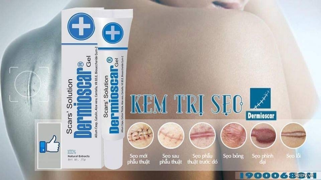 Kem trị sẹo Dermioscar - 2