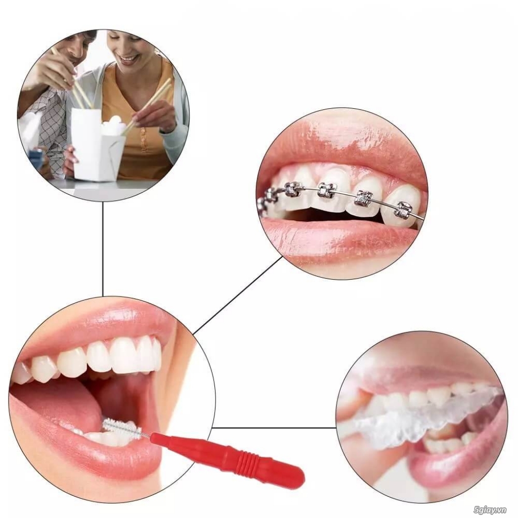 Tăm răng INOX vệ sinh khe kẽ răng, phù hợp cho những bạn niềng răng - 1