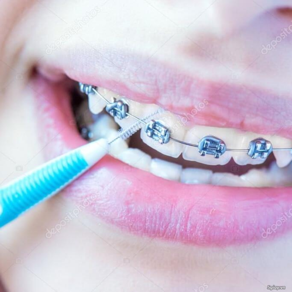 Tăm răng INOX vệ sinh khe kẽ răng, phù hợp cho những bạn niềng răng