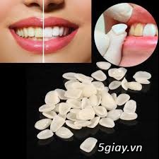 Dịch vụ nha khoa tại TPHCM - 13