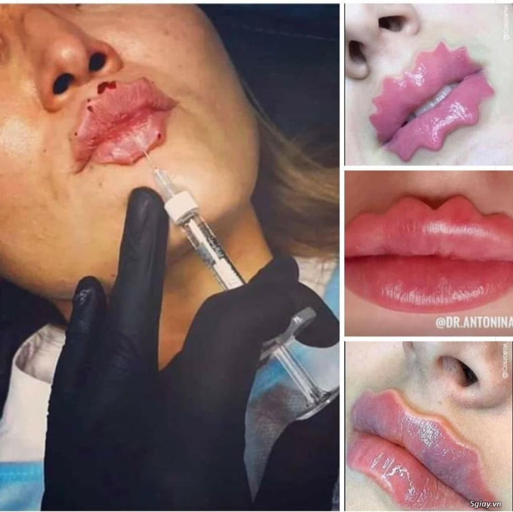 Hình hài hước... Nhiều thể loại vui nhôn - 3